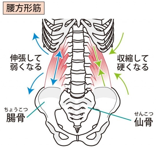 腰痛の原因となる筋肉を徹底解説します 横浜市の整体あくわ整骨院